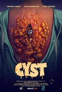 Cyst