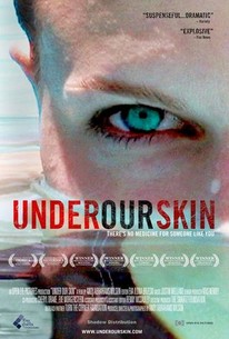 Under Our Skin