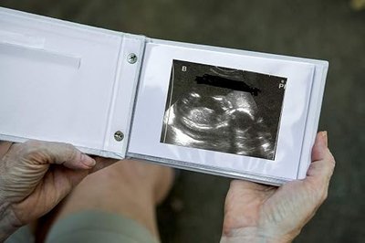 Pregnancy/Maternity Ultrasound And Photo Album/Keepsake