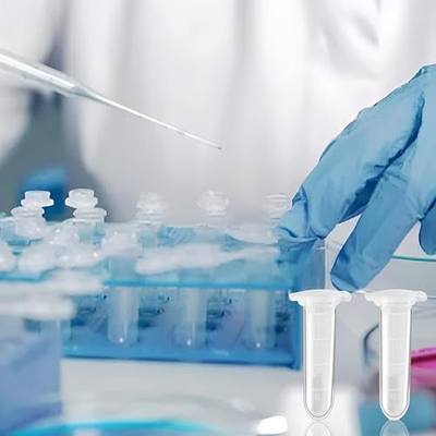 100pcs 2ml Plastic Vials, Centrifuge Tubes | Plastic Small Vials with Caps for Sample Storage, Tubes for Container Liquid