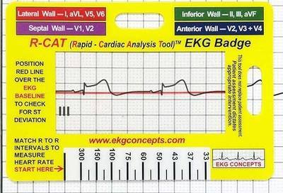 EKG Interpretation Tool/R-CAT Badge Card | Accurately Interpret ECG/EKG Rhythm Strips and 12 Lead EKG, Without Calipers, Badge Buddy
