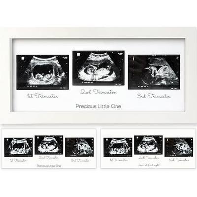 KeaBabies Baby Sonogram Picture Frames,Trio Ultrasound Photo (Alpine White) | Ultrasound Picture Frames, First Time Mom Gift, Cute Pregnancy Reveal Photo, Baby Gender Reveal Gift, Newborn Nursery Decor