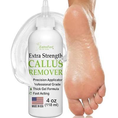 Dr. Entre's Callus Remover Gel: Extra Strength Callus Remover for Feet, Foot Callus Remover, Foot Care, Pedicure Tools Supplies, Dead Skin Remover, 4 oz