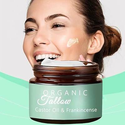 WERANOZ Organic Grass Fed Whipped Tallow Cream with Castor Oil & Frankincense Oil, All-Natural Moisturizer, Hydrating Beef Tallow Moisturizer Cream and Manuka Honey Balm for Skin (1)