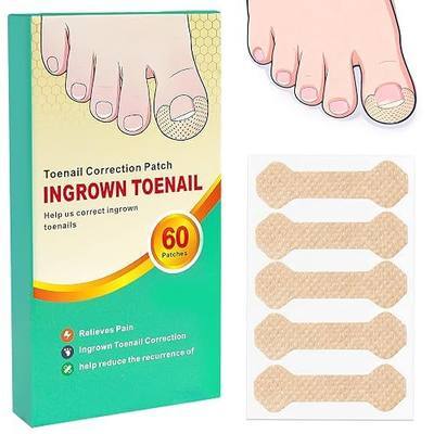 Ingrown Toenail Treatment, 60 Pcs Breathable Ingrown Toenail Strips | Toenail Corrector Patch for Ingrown Toenail Relief, Painless Toenail Support Tool, At-Home Pedicure Foot Care, 60 Count